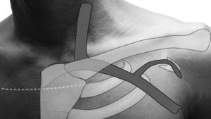 anatomic considerations for venous access