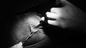 incision and creation
